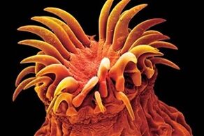 Մարդկանց մեջ տրեմատոդային մակաբույծներ