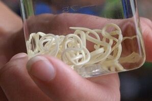 մակաբույծներ մարդու մարմնից