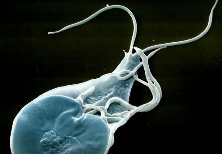 մարդկանց մոտ աղիքային լամբլիա